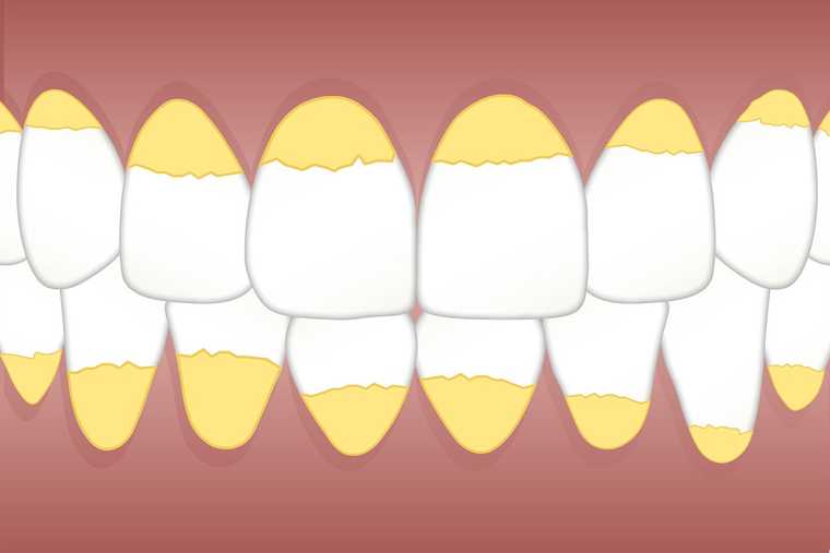 Sarro dental