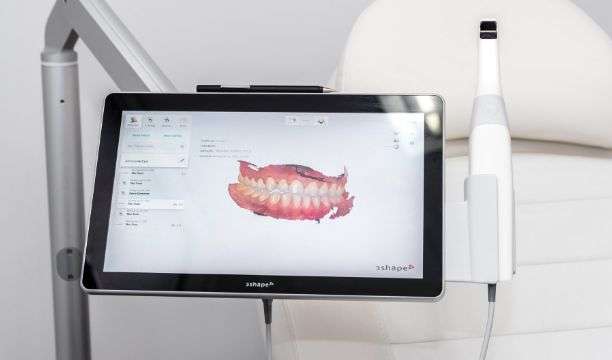Foto de un escáner 3D y su simulación 3D de una mandíbula tras un examen DR SMILE